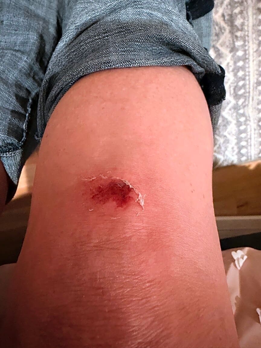 Image submitted with report