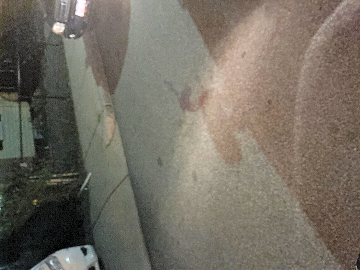 Image submitted with report