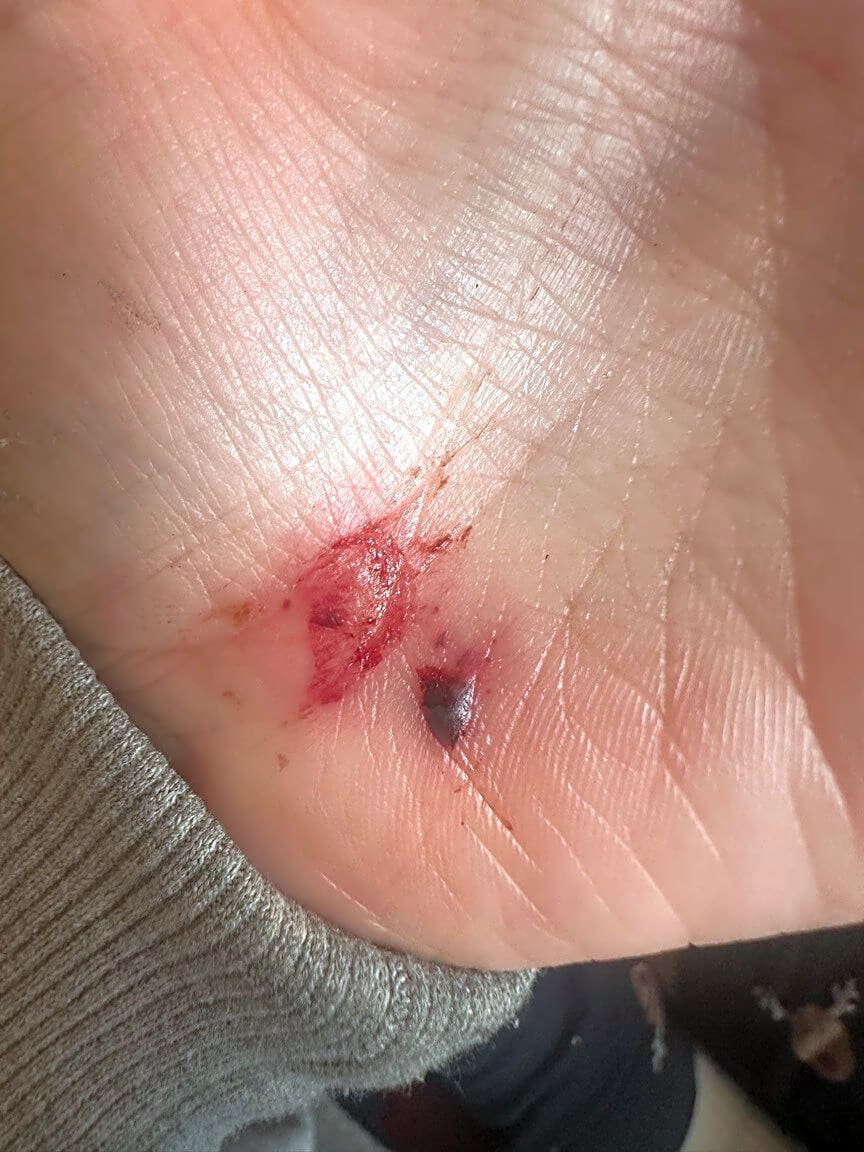 Image submitted with report