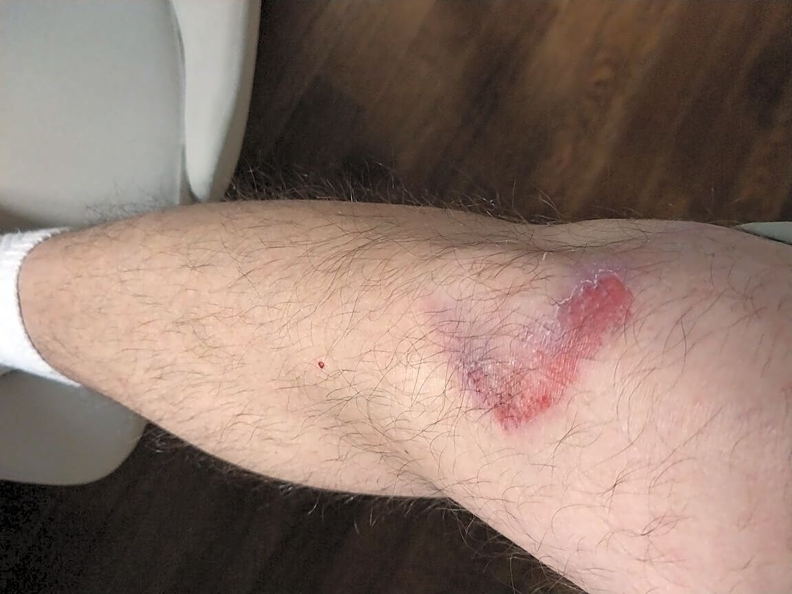 Image submitted with report